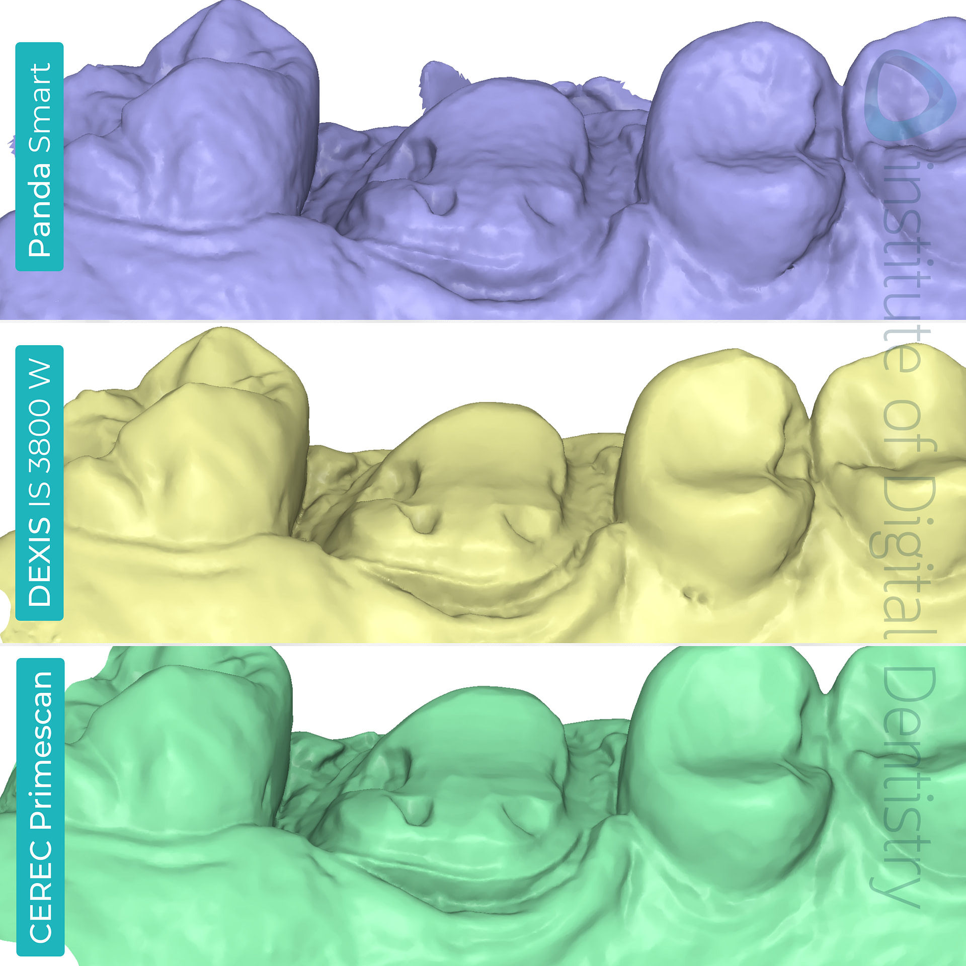 panda-smart-dexis-is-3800-w-cerec-primescan-dentsply-sirona-medit-design-software-stl-file-scan-prep-margin-line-palatal-view-idd-compares-institute-of-digital-dentistry-blog