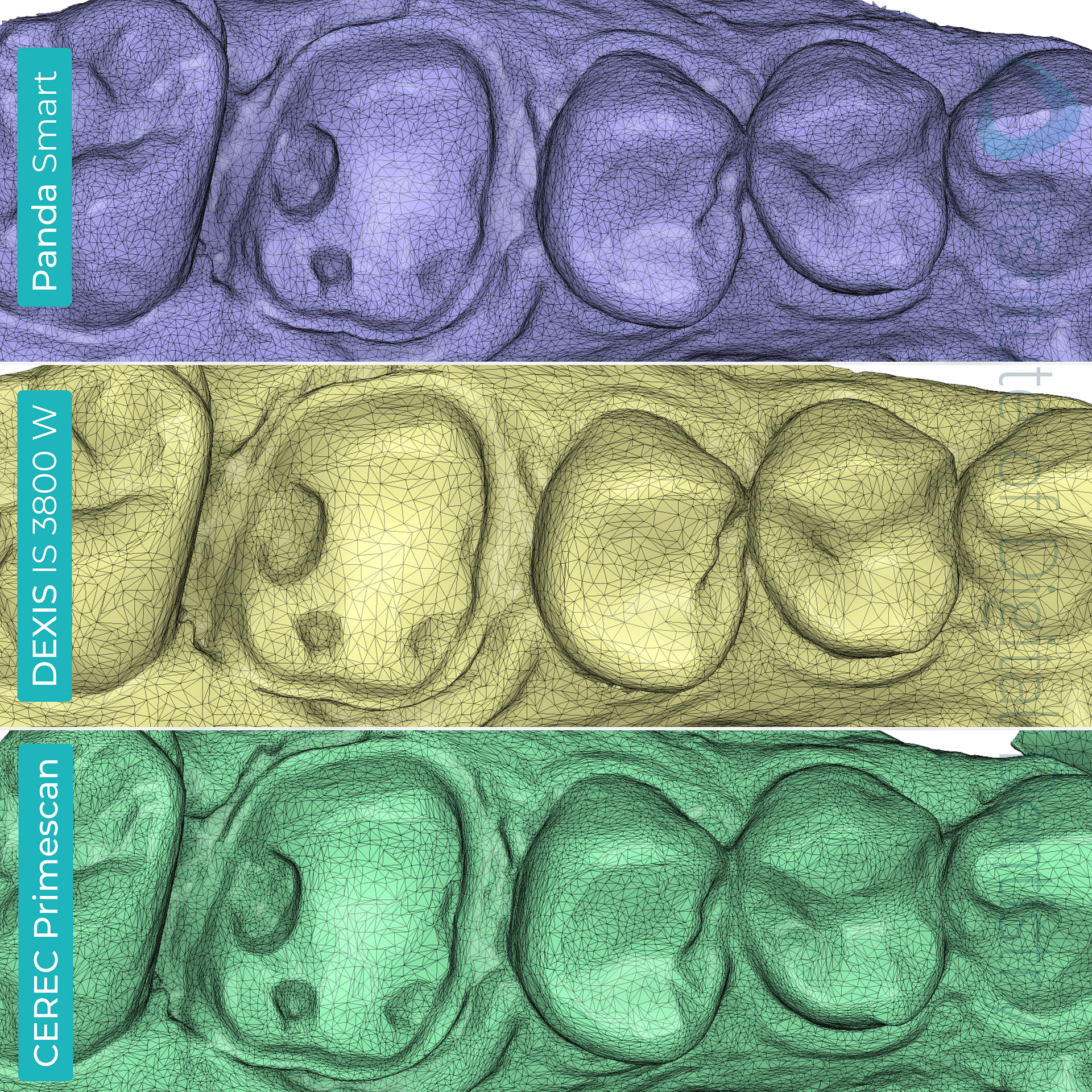 panda-smart-dexis-is-3800-w-cerec-primescan-dentsply-sirona-medit-design-software-stl-file-scan-tessellation-mesh-density--idd-compares-institute-of-digital-dentistry-blog