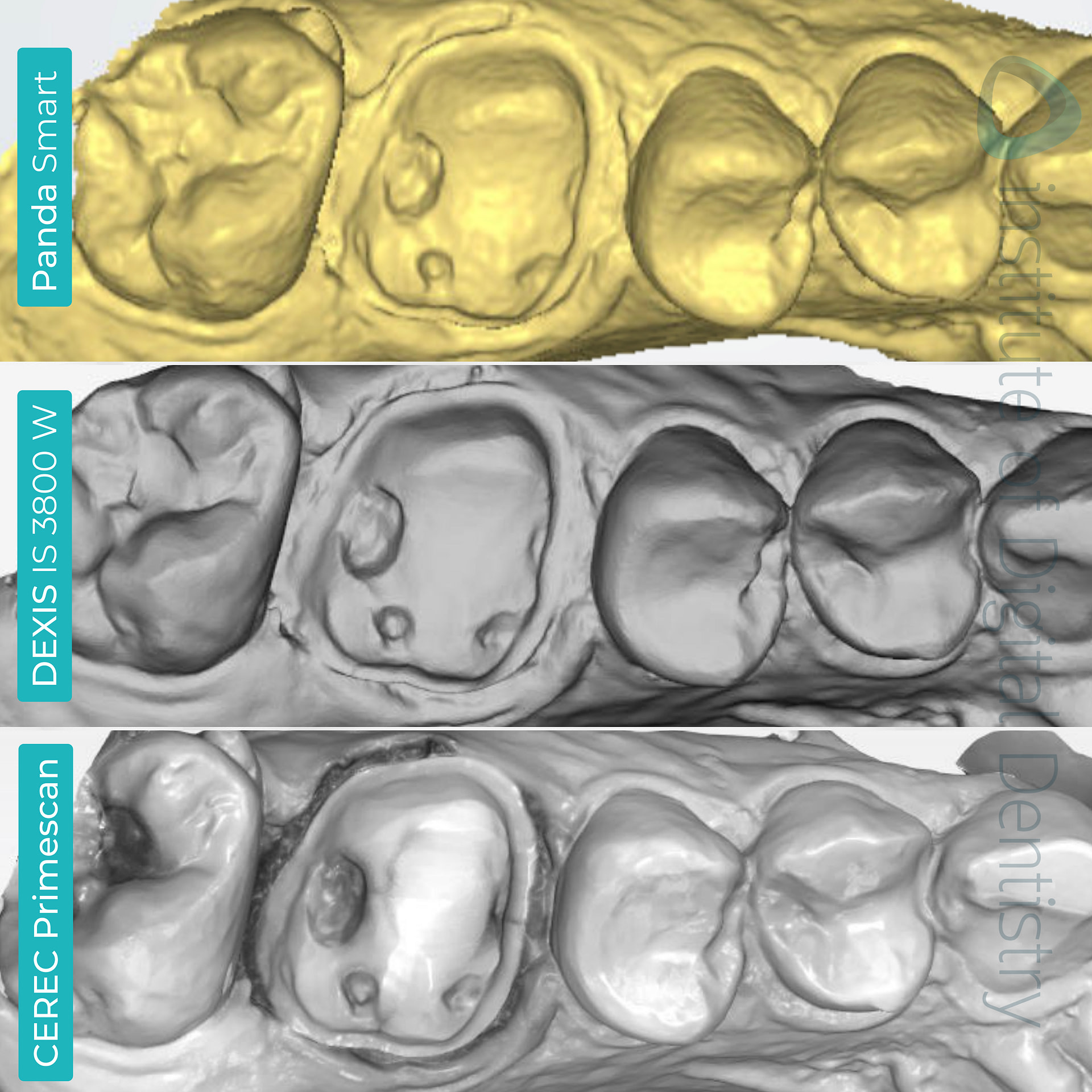 panda-smart-dexis-is-3800-w-cerec-primescan-dentsply-sirona-native-monochrome-scans-idd-compares-institute-of-digital-dentistry-blog