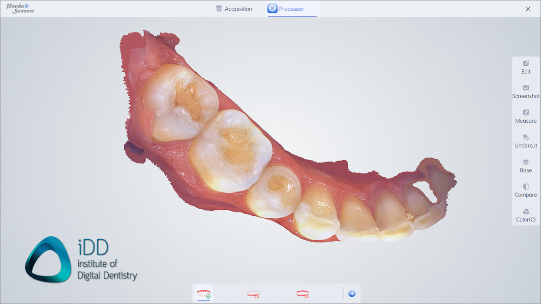 panda_smart_IOS_review_intraoral_scanner_institute_of_digital_dentistry (16)
