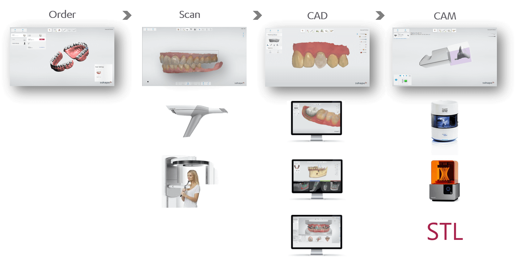 3shape-digital-workflow-idd-blog-institute-of-digital-dentistry-blog