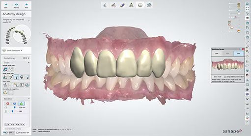 3shape-intraoral-scan-trios-software-idd-institute-of-digital-dentistry-blog