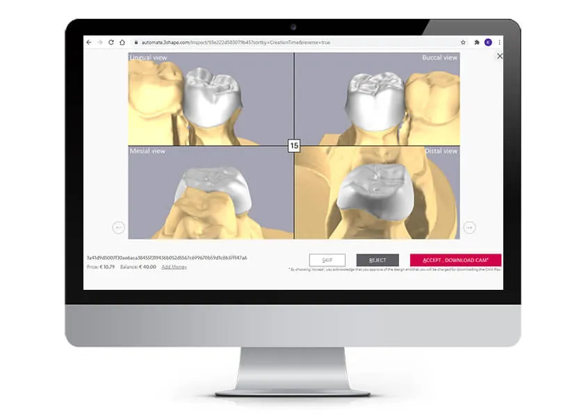 idd-digital-dentistry-3shape-trios5-intraoral-scanner-review-automate-2024-software-ai-crown-cad