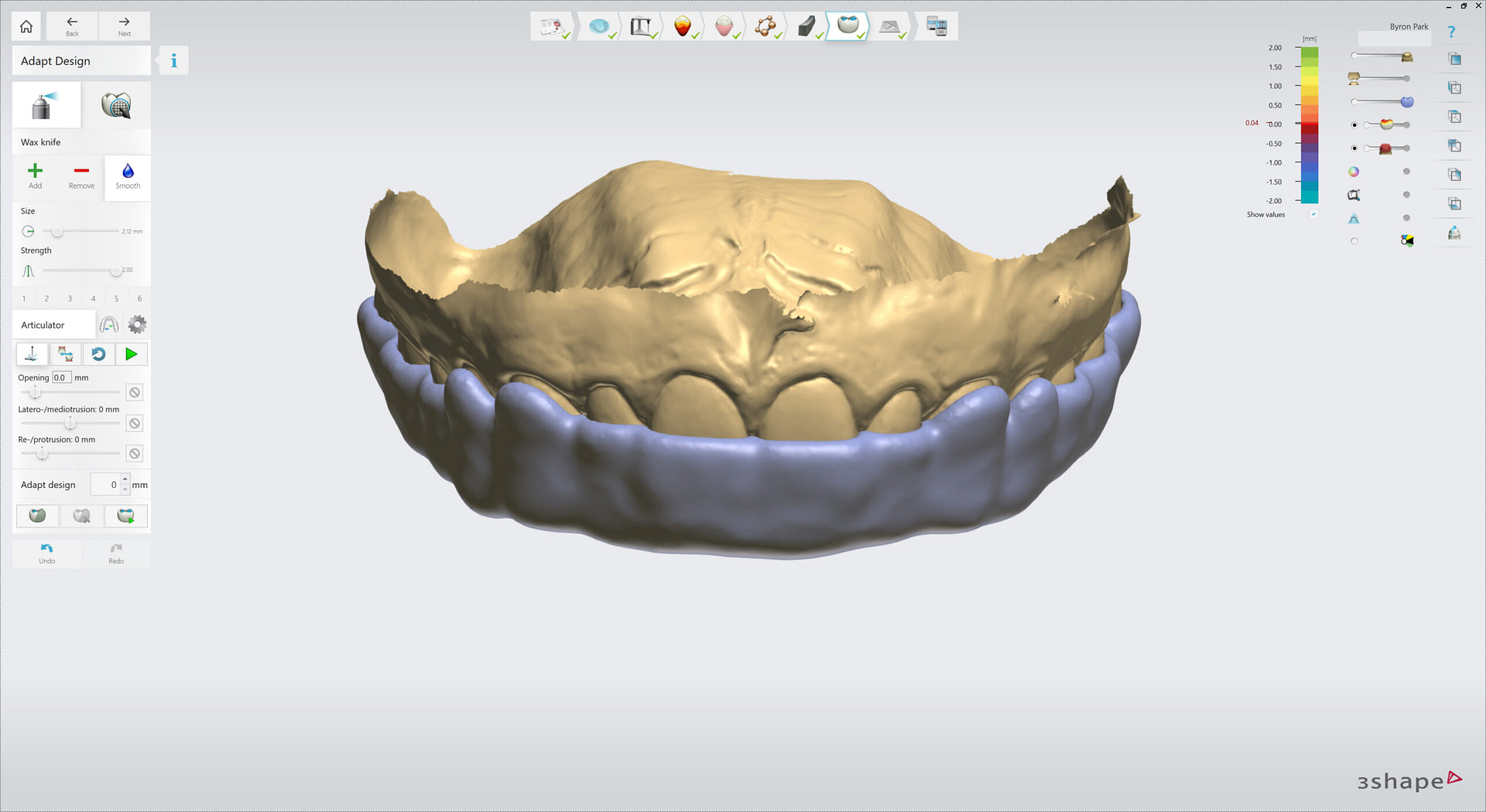 3shape-intraoral-trios-scan-bite-splint-idd-institute-of-digital-dentistry-blog-byron-park-splint-studio-final-smoothing