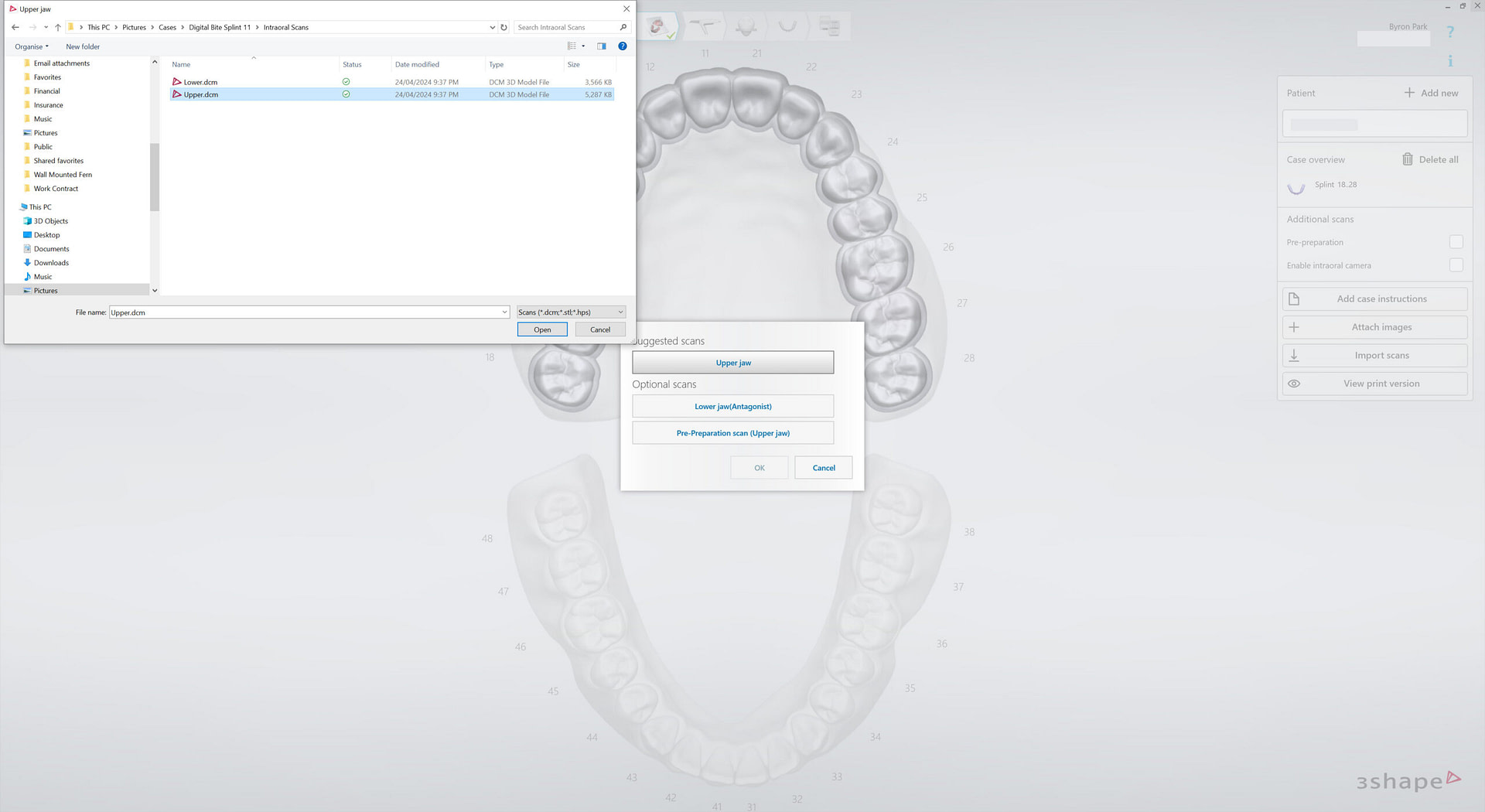 3shape-intraoral-trios-scan-bite-splint-idd-institute-of-digital-dentistry-blog-byron-park-splint-studio-import-scans