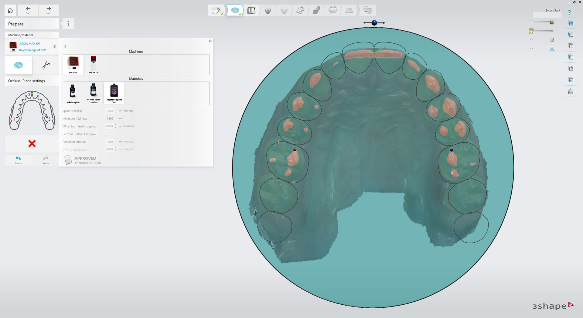 3shape-intraoral-trios-scan-bite-splint-idd-institute-of-digital-dentistry-blog-byron-park-splint-studio-occlusal-plane