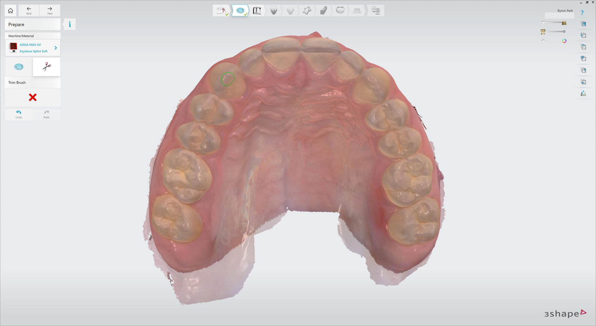3shape-intraoral-trios-scan-bite-splint-idd-institute-of-digital-dentistry-blog-byron-park-splint-studio-trim-brush-scan