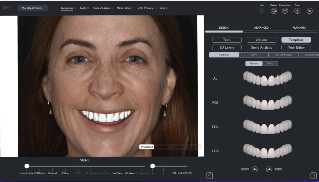 DDD_Podcast_09_SmileFy_Ralph_Georg_Digital_Dentistry_Decoded_Podcast-ai-digital-smile-design-dsd-case-study