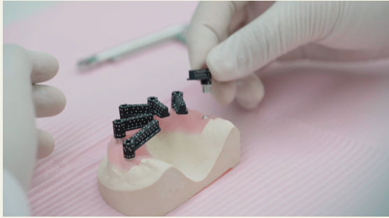 Scan-body---screwdriver