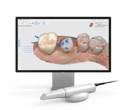 idd-compares-comparing-medit-i900-i700-wireless-vs-i700-vs-i600-vs-i500-scanners-idd-software