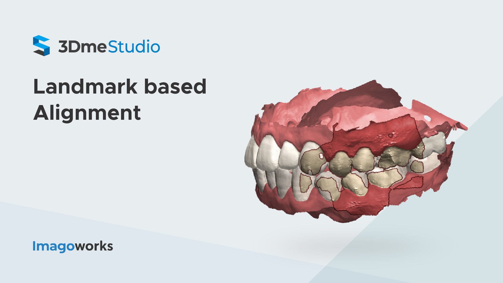 imagoworks-dentbird-ai-alignment-design-web-dental-cad-3dme-idd-institute-of-digital-dentistry-podcast-blog