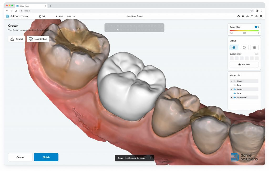 imagoworks-dentbird-ai-crown-design-web-dental-cad-3dme-idd-institute-of-digital-dentistry-podcast-blog