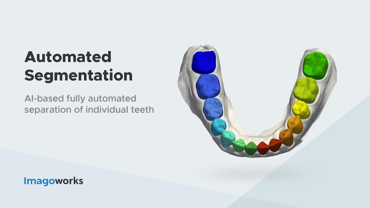 imagoworks-dentbird-ai-tooth-segmentation-design-web-dental-cad-3dme-idd-institute-of-digital-dentistry-podcast-blog