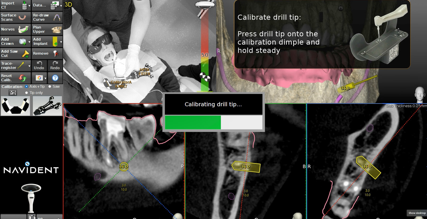 navident-evo-claronav-dynamic-navigation-idd-institute-of-digital-dentistry-dr-byron-park-first-impressions-calibrate-drill-tip
