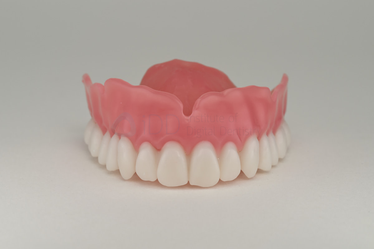 rodin-soft-reline-kit-3d-printed-dentures-workflow-blog-idd-institute-of-digital-dentistry-3d-printed-denture-uncharacterized-unpolished-2