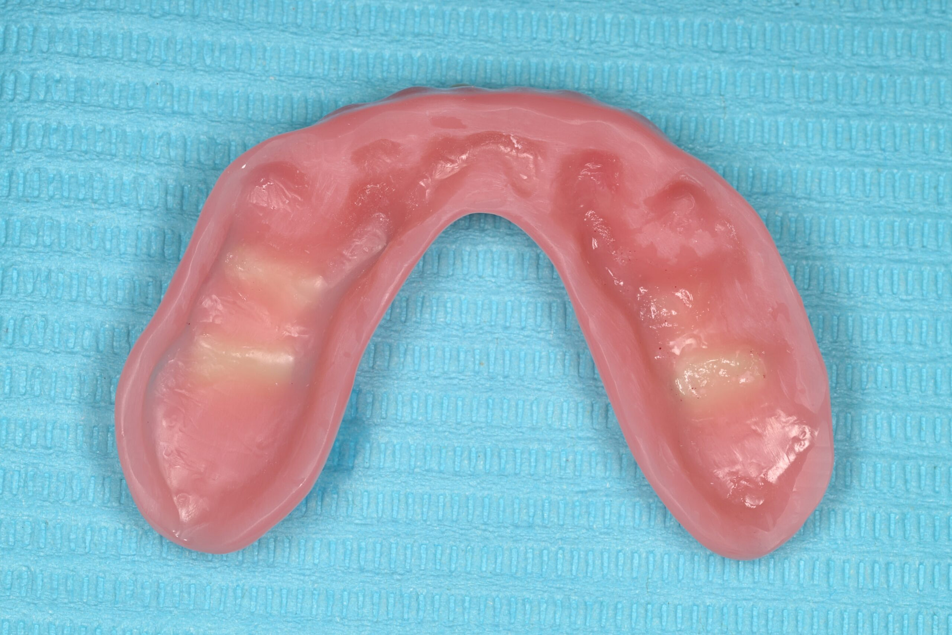 rodin-soft-reline-kit-3d-printed-dentures-workflow-blog-idd-institute-of-digital-dentistry-lower-denture-bevel-border-intaglio-surface