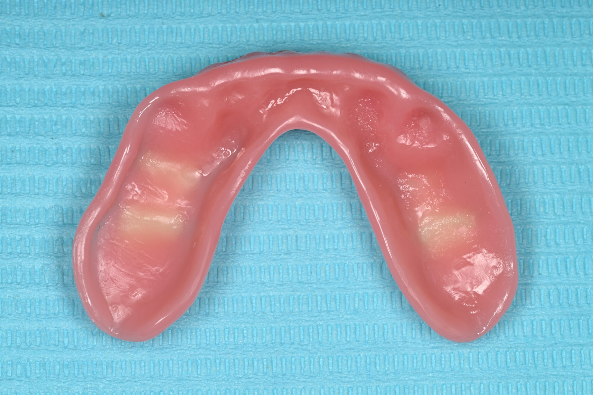 rodin-soft-reline-kit-3d-printed-dentures-workflow-blog-idd-institute-of-digital-dentistry-lower-denture-clean-intaglio-surface-application