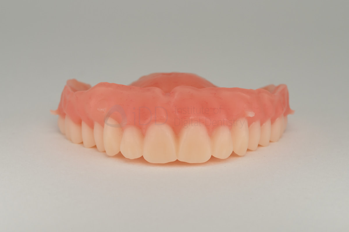 rodin-soft-reline-kit-3d-printed-dentures-workflow-blog-idd-institute-of-digital-dentistry-milled-ivotion-denture-unpolished-2
