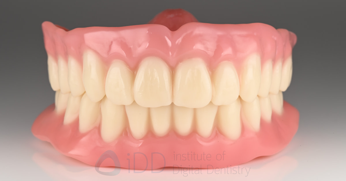 rodin-soft-reline-kit-3d-printed-dentures-workflow-blog-idd-institute-of-digital-dentistry-polished-finished-3d-printed-denture-upper-lower-full-full