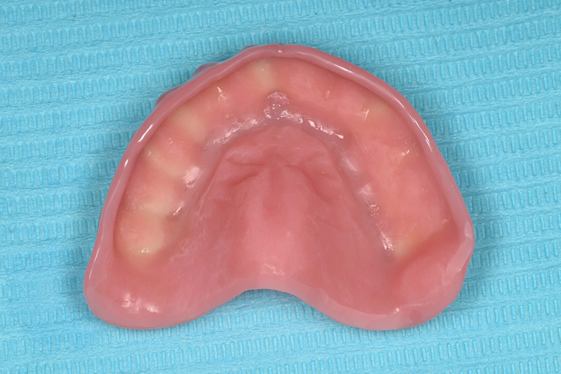 rodin-soft-reline-kit-3d-printed-dentures-workflow-blog-idd-institute-of-digital-dentistry-upper-denture-bevel-border-intaglio-surface