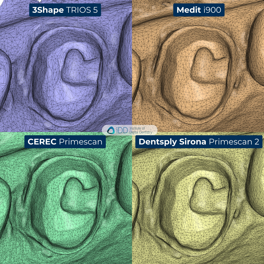 dentsply-sirona-primescan-2-3shape-trios-5-medit-i900-cerec-primescan-intraoral-scanner-comparison-idd-compares-institute-of-digital-dentistry-blog-mesh-density