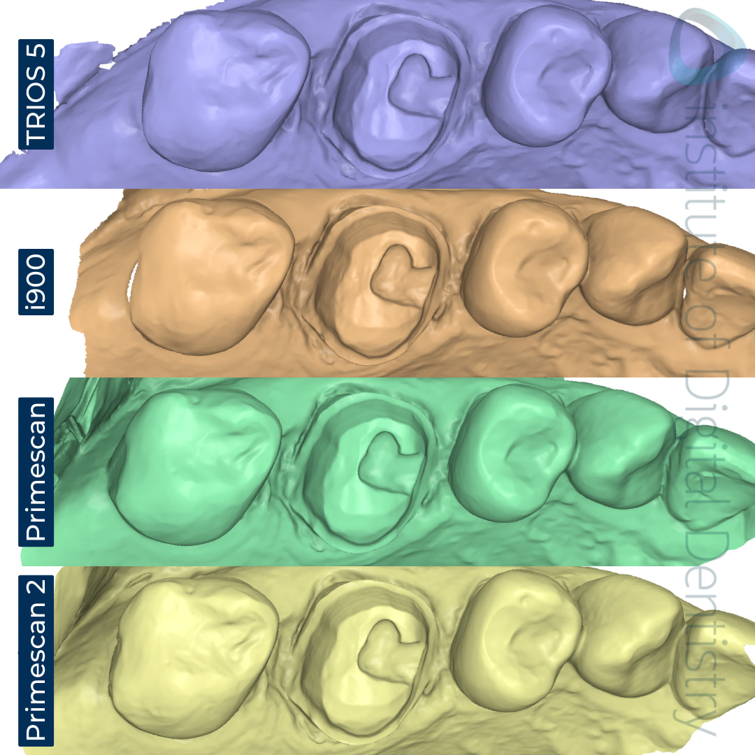 dentsply-sirona-primescan-2-3shape-trios-5-medit-i900-cerec-primescan-intraoral-scanner-comparison-idd-compares-institute-of-digital-dentistry-blog-stl-scan-file-format-medit-design