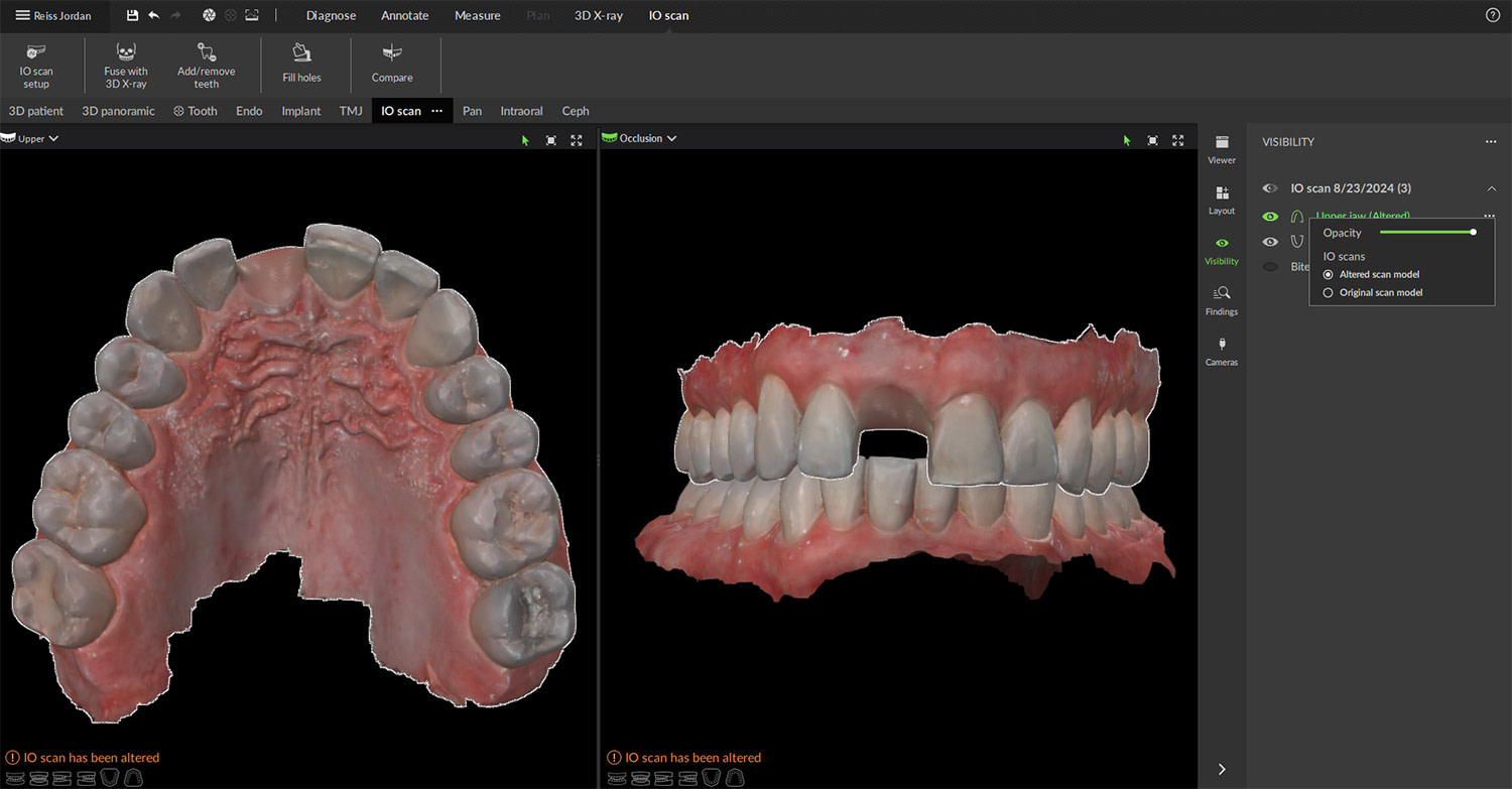dexis_3800_DTX_studio_clinic_iDD_review_digital_dentistry5