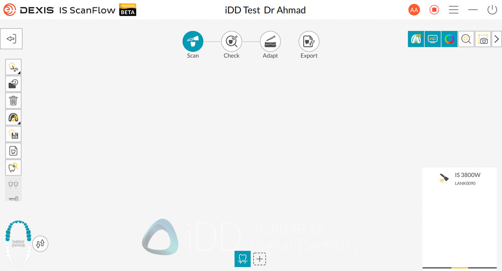 dexis_3800_wireless_intraoral_scanner_review_institute_of_Digital_dentistry16