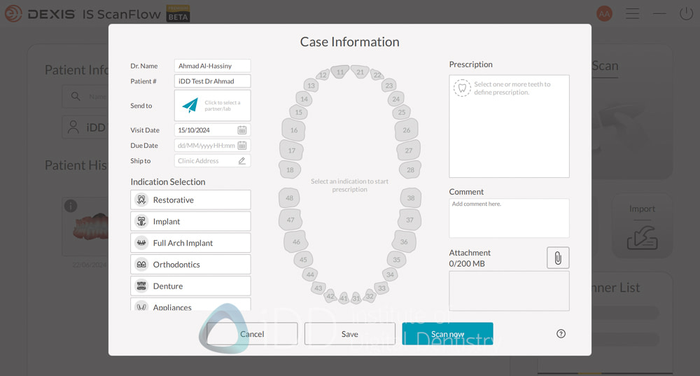 dexis_3800_wireless_intraoral_scanner_review_institute_of_Digital_dentistry28