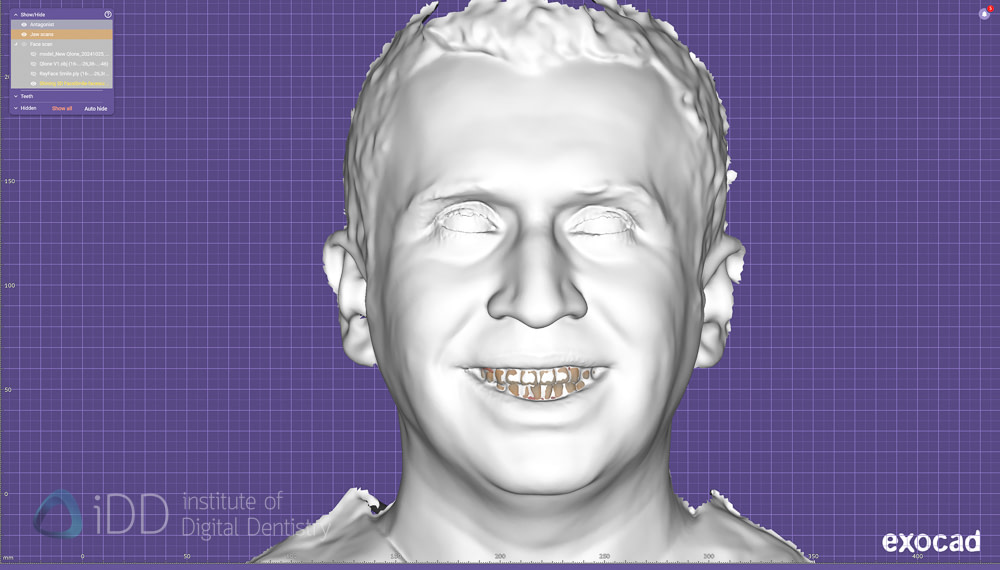 face_scanner_review_dentistry_iDD24