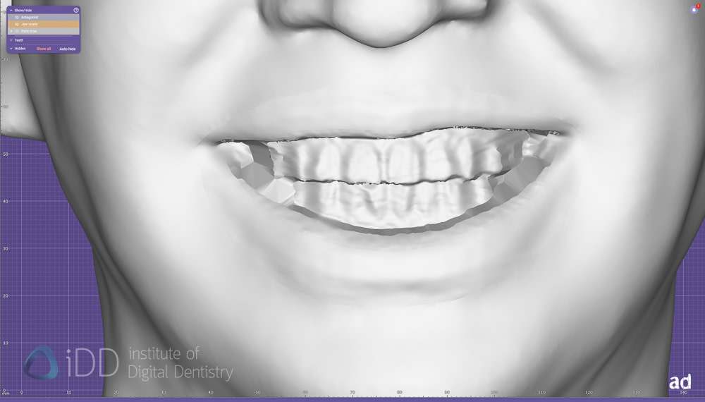 face_scanner_review_dentistry_iDD28