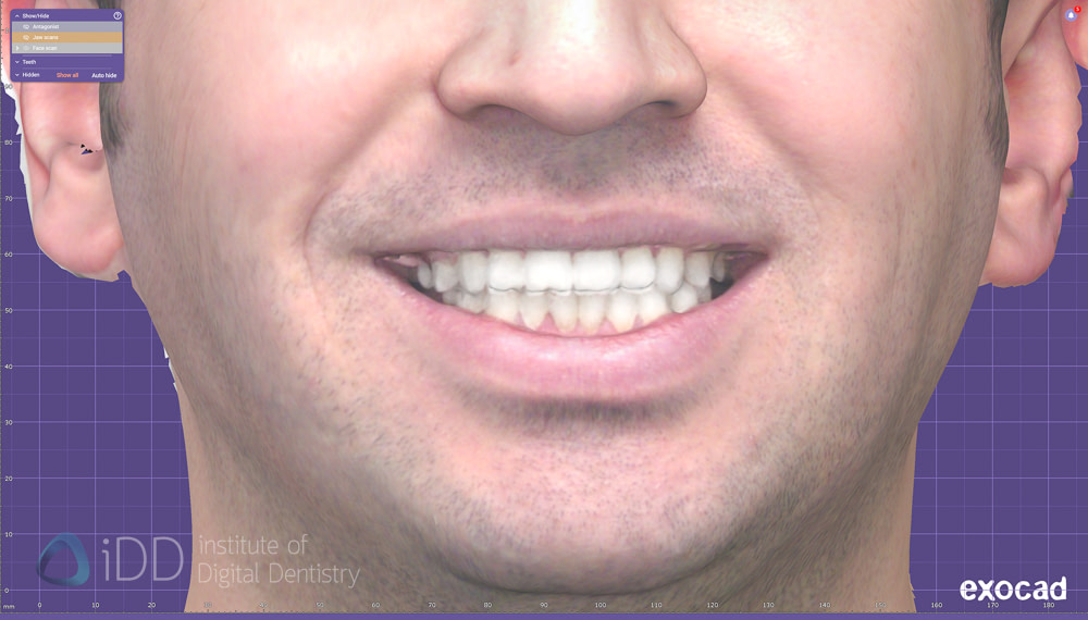 face_scanner_review_dentistry_iDD6