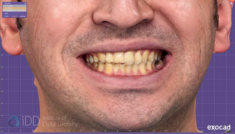 face_scanner_review_dentistry_iDD8