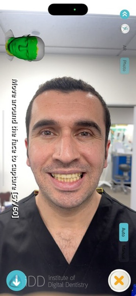 qlone_dental_app_face_scanning_Ray_metismile2