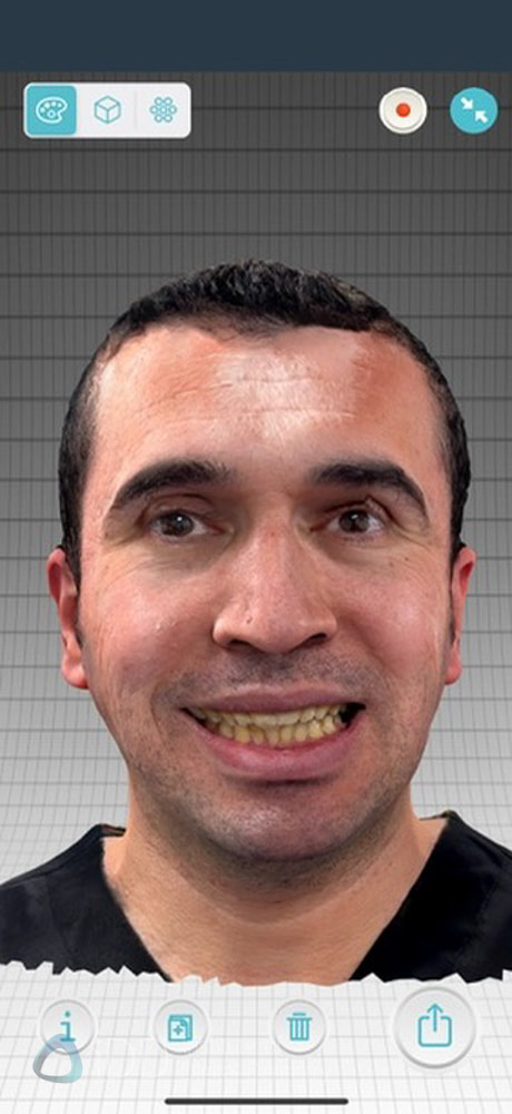 qlone_dental_app_face_scanning_Ray_metismile7