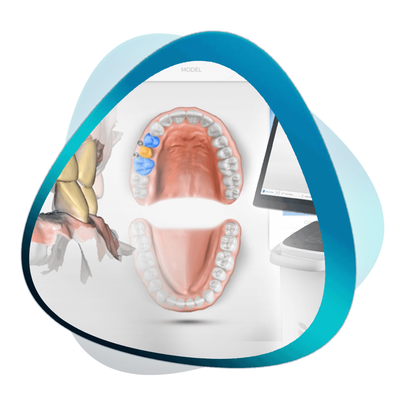 CEREC Masterclass-V2