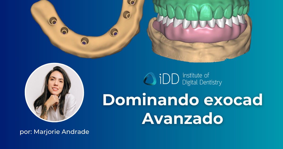 Dominando-exocad-Avanzado