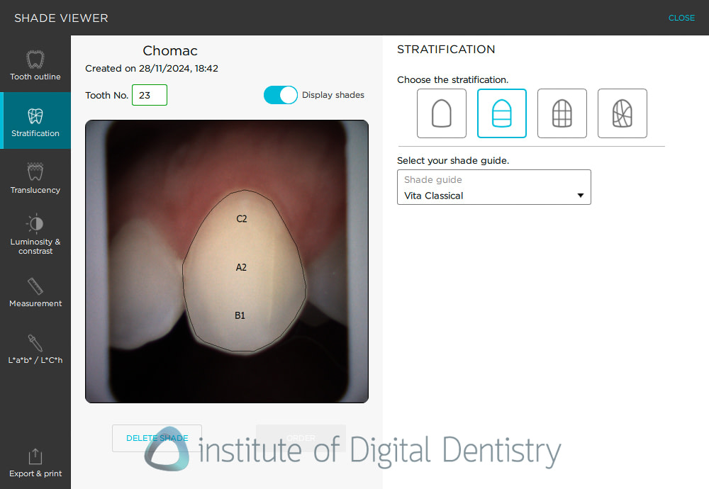borea_cobra_dental_shade_matching2