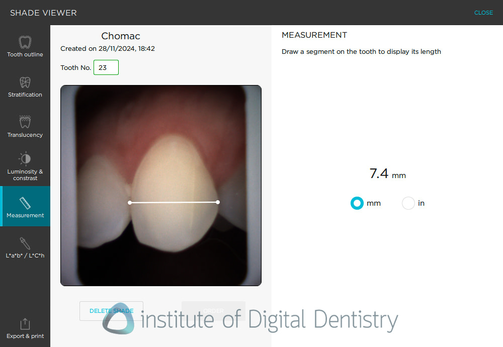 borea_cobra_dental_shade_matching5