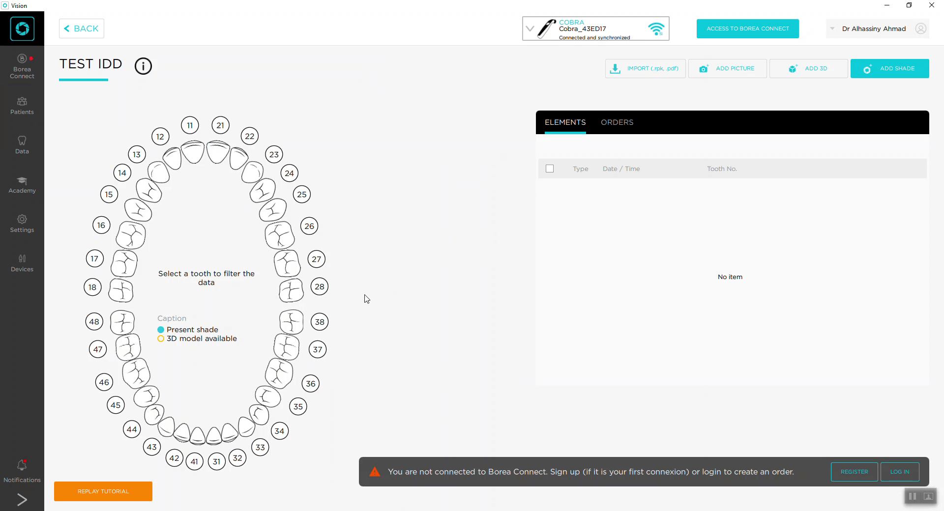 borea_cobra_review_iDD_institute_of_digital_dentistry (2)
