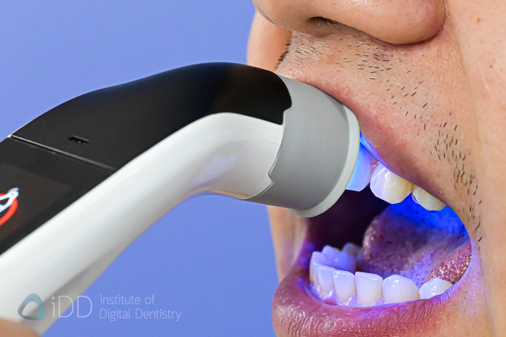 borea_cobra_shade_matching_dentistry_Dental Spectrophotometers and Shade-Matching_iDD16