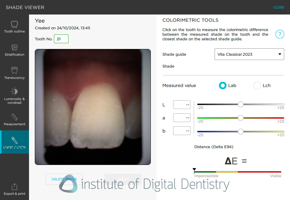 borea_cobra_smart_shade_digital_dentistry_iDD1