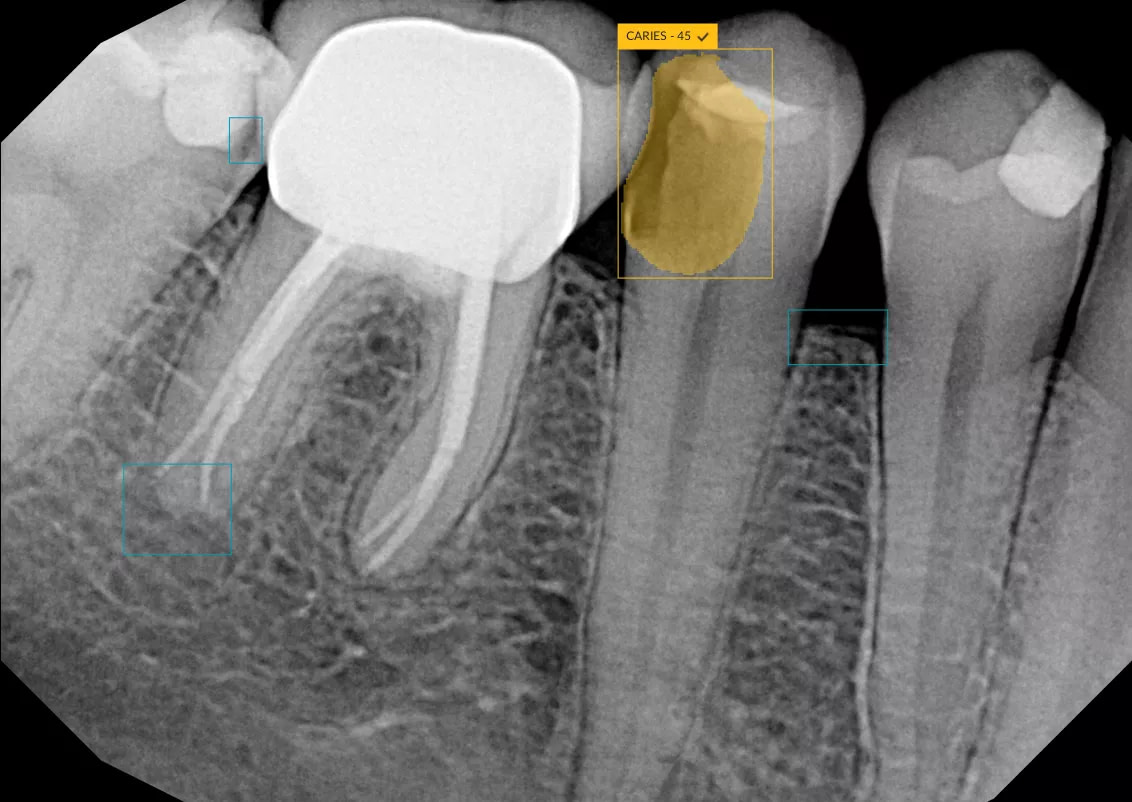 dexis-ai-dtxassist-idd-digital-dentistry-decoded-podcast-jordan-reiss