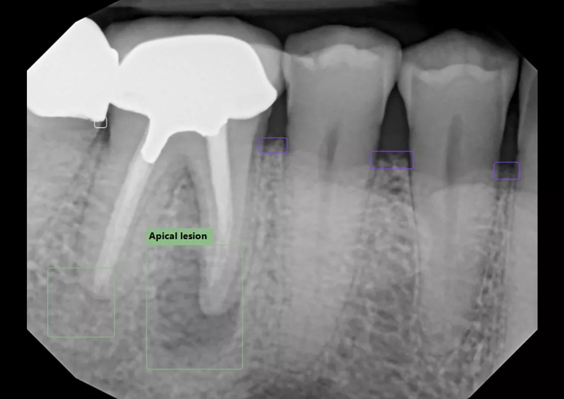 dexis-ai-dtxassist-lesions-idd-digital-dentistry-decoded-podcast-jordan-reiss
