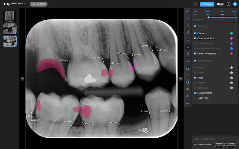 pearl_second_opinion_review_iDD1