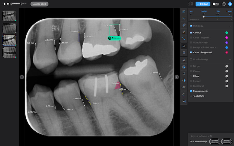 pearl_second_opinion_review_iDD2