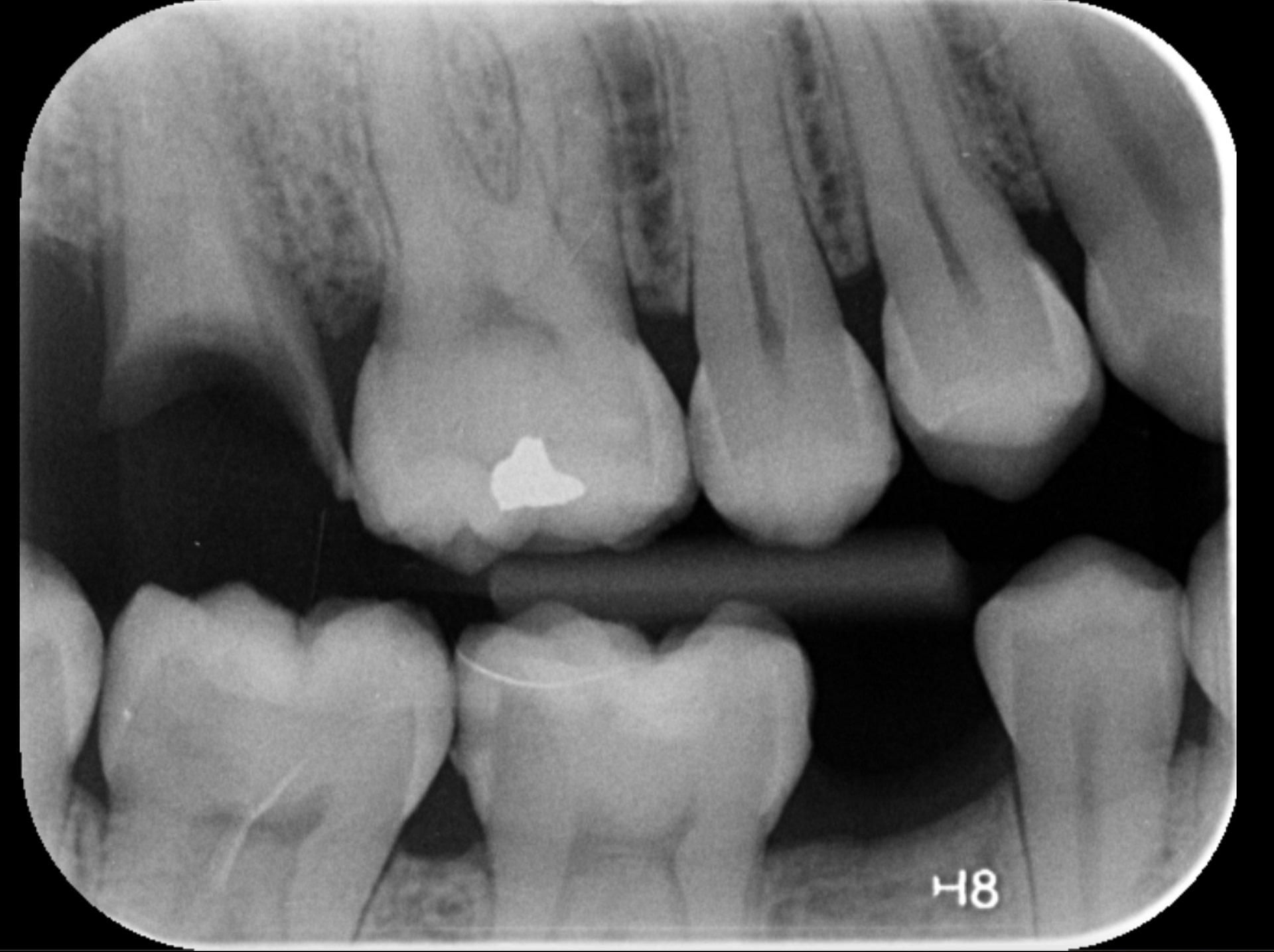 pearl_second_opinion_review_iDD3