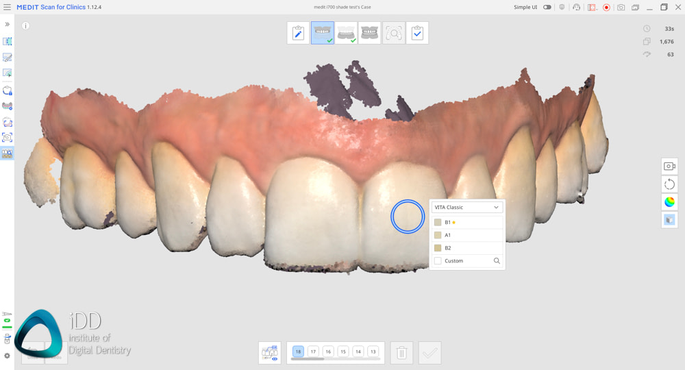 shade matching test intraoral scanners institute of digital dentistry (26)
