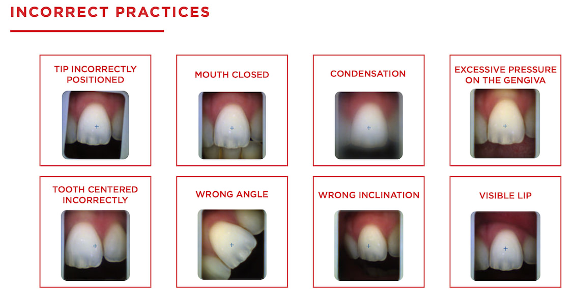 shade_matching_device_dentistry_Borea_iDD2