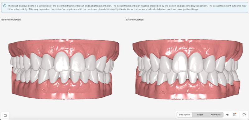 sure_smile_simulator2